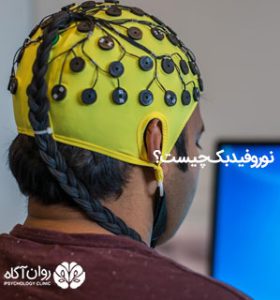 نوروفیدبک