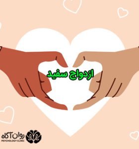 ازدواج سفید چیست